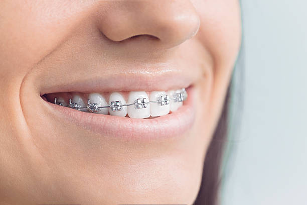 Best Invisalign and Clear Aligners  in Chrisman, IL